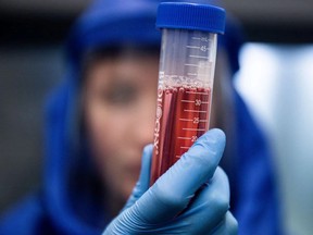 A scientist displays a test sample during diagnostic activity relating to SARS-CoV-2, the virus strain causing the coronavirus disease. (AKOS STILLER /Bloomberg)