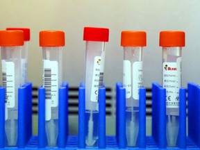Patient swabs await testing for COVID-19 in a medical microbiology laboratory.