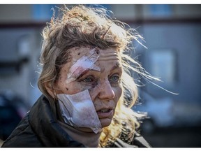 A wounded woman stands outside a hospital after the bombing of the eastern Ukraine town of Chuguiv on February 24, 2022, as Russian armed forces attempt to invade Ukraine from several directions, using rocket systems and helicopters to attack Ukrainian position in the south, the border guard service said. - Russia's ground forces crossed into Ukraine from several directions, Ukraine's border guard service said, hours after President Vladimir Putin announced the launch of a major offensive. Russian tanks and other heavy equipment crossed the frontier in several northern regions, as well as from the Kremlin-annexed peninsula of Crimea in the south, the agency said.