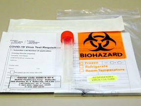 A COVID-19 testing kit rests on a countertop in the medical microbiology laboratory of Belleville General Hospital.