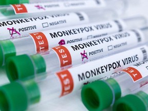 Test tubes labelled "Monkeypox virus positive and negative" are seen in this illustration taken May 23, 2022. (REUTERS/Dado Ruvic)