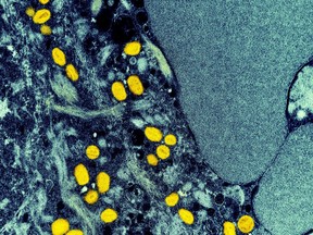 A colourized transmission electron micrograph of monkeypox particles (yellow) found within an infected cell (blue), is shown in a handout photo captured at the NIAID Integrated Research Facility (IRF) in Fort Detrick, Maryland. Ontario has expanded the eligibility for the monkeypox vaccine to include a broader segment of the LGBTQ population and sex workers. The new guidelines from the Ministry of Health expand the pre-exposure monkeypox vaccine to people who are two-spirit, non-binary or transgender and who belong to the LGBTQ community, or who have partners that identify as such. THE CANADIAN PRESS/HO-National Institute of Allergy and Infectious Diseases **MANDATORY CREDIT**