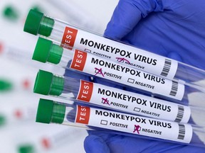 Test tubes labelled "Monkeypox virus positive and negative" are seen in this illustration taken May 23, 2022.