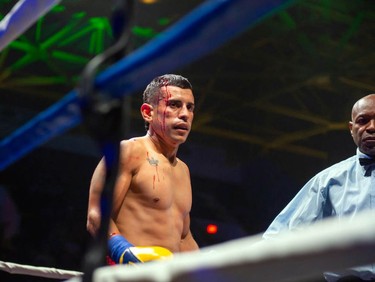 Isaac Casten got bloodied up during his fight against Montreal's Mohamed Soumaoro on Monday August 8, 2022 in Cornwall, Ont. Soumaoro won in a unanimous decision after six rounds. Robert Lefebvre/Special to the Cornwall Standard-Freeholder/Postmedia Network