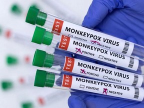 The Monkeypox virus. (file photo)