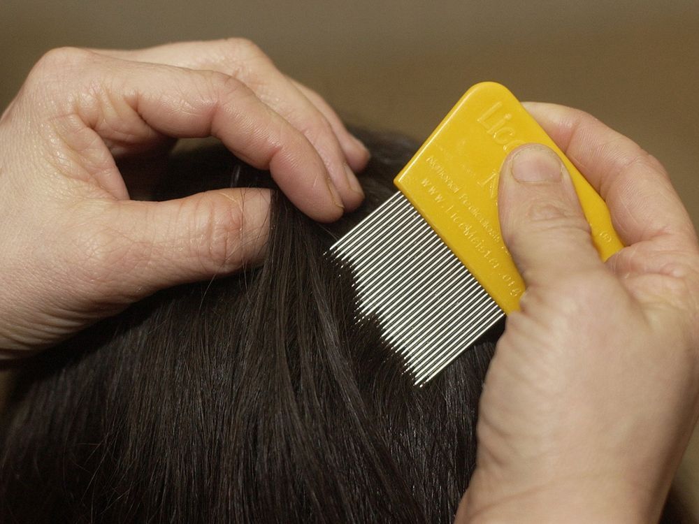 What Might I Expect? Human blood necessary for head lice survival The