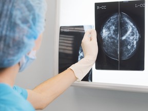 ‘Many’ mammograms deferred due to pandemic or ‘personal choice’