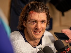 Morgan Barron of the Jets was cut for 75-plus stitches on Tuesday and his return to the game garnered attention across the sportsworld.