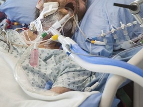 A COVID-19 patient breathes with the help of a ventilator at Surrey Memorial Hospital in Surrey, B.C., June 4, 2021.