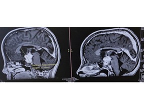 Brain scan is pictured here.