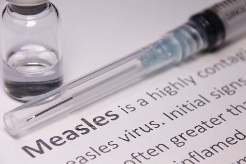 Measles Exposure Alert Stay Informed and Stay Safe