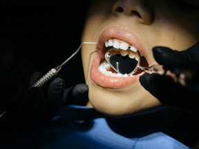 Opinion: Why New Brunswick children are being left behind in dental care Opinion: Why New Brunswick children are being left behind in dental care