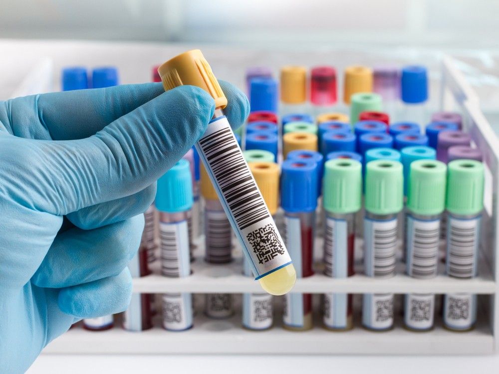 Health coalition says hospital should do bloodwork, not private lab