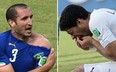This combo of 2 photos shows Italy's defender Giorgio Chiellini (L) showing an apparent bitemark and Uruguay forward Luis Suarez (R) holding his teeth after the incident during the Group D football match between Italy and Uruguay at the Dunas Arena in Natal during the 2014 FIFA World Cup on June 24, 2014. (DANIEL GARCIA/AFP/Getty Images)