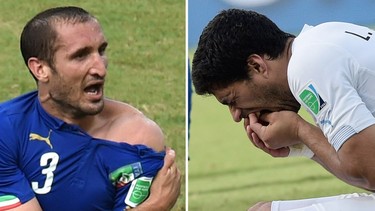 This combo of 2 photos shows Italy's defender Giorgio Chiellini (L) showing an apparent bitemark and Uruguay forward Luis Suarez (R) holding his teeth after the incident during the Group D football match between Italy and Uruguay at the Dunas Arena in Natal during the 2014 FIFA World Cup on June 24, 2014. (DANIEL GARCIA/AFP/Getty Images)