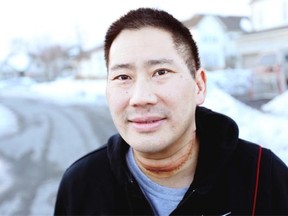 Dean Liu, an Ottawa dentist, is lucky to be alive after a recent bout of flesh eating disease in his neck.