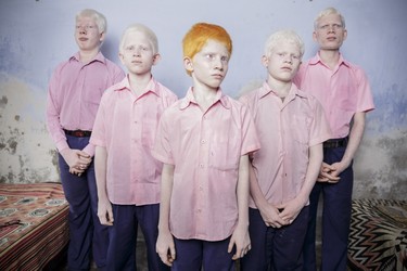 Brent Stirton, South Africa, Reportage by Getty Images, 25 September 2013, West Bengal India.
A group of blind albino boys photographed in their boarding room at the Vivekananda mission school for the blind in West Bengal, India. This is one of the very few schools for the blind in India today.