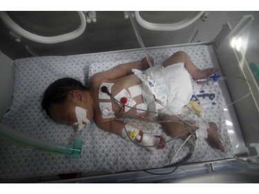 A Palestinian baby girl, Shayma Sheikh al-Eid, lies in an incubator at Nasser Hospital, two days after surgeons delivered her after her 23-year-old mother died, on July 27, 2014, in Khan Yunis in the southern Gaza Strip. The baby's mother died of her wounds on July 25, 2014 after an Israeli air strike hit a house in the central Gaza town of Deir al-Balah, emergency services spokesman Ashraf al-Qudra said.