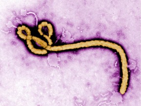 The Centers for Disease Control released this colorized electron micrograph of an Ebola virus virion.