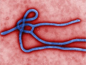 FILE - This undated file image made available by the Centers for Disease Control (CDC) shows the Ebola virus.