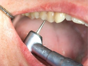 Some children from low-income families could lose dental care under a provincial plan, critics are warning.