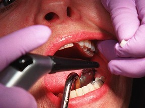 Dental work being done at an Ottawa clinic.