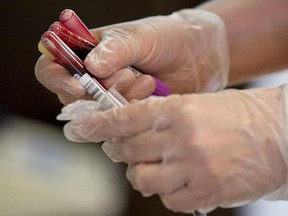 Ontario Health Study workers plan to draw blood at the Nepean Sportsplex at 1701 Woodroffe Ave., the Ottawa Conference and Event Centre at 200 Coventry Rd., and the Bruyère Research Institute at 75 Bruyère St. in Lowertown.