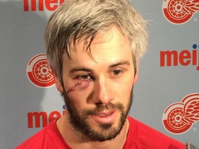 Detroit Red Wings forward Drew Miller displays the 60-stitch cut he received from Mark Stone's skate blade in Tuesday's game against Ottawa.