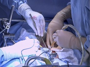 Surgeons perform a live liver transplant in February in Toronto.