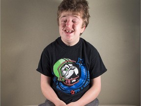 Tysen Lefebvre, 14, who has Pfeiffer Syndrome Type 2, is in the middle of what he has labelled his Mission to a Million'. Tysen is trying to raise $1 million for the Make a Wish foundation to help 100 others get a chance to have their wishes come true.