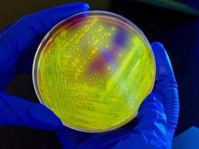 A new study looks at how high antibiotics use affects the health of nursing home residents. C. difficile bacteria in a petri dish is shown in an undated photo. THE CANADIAN PRESS/ho-Centers for Disease Control and Prevention