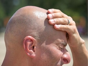 Alex Torok-Nagy slathers some sunscreen on his head while at Mooney's Bay as the heat wave in Ottawa continued for another day.