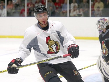 Prospect Gabriel Gagne #71 of the Ottawa Senators suffers a bloody lip during a scrimmage at the Kanata Recreation Centre in Ottawa on July 2, 2015.