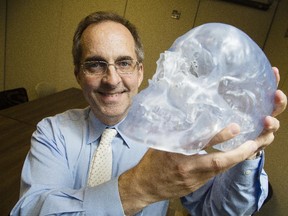 Dr. Frank Rybicki with a 3D-printed model of a skull in his office at The Ottawa Hospital.