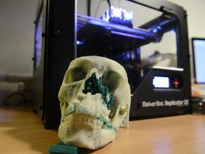 A 3D printer used by a clinic in France to create skull and facial implants.