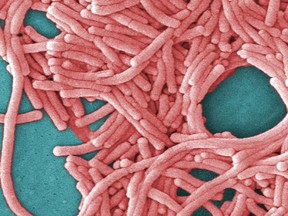 This undated image made available by the Centers for Disease Control and Prevention shows a large grouping of Legionella pneumophila bacteria.