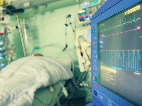 Local Input~ Monitoring of the patient in hospital     /   //  **CLEARED FOR ALL POSTMEDIA USE**  
UNDATED --   hospital patient intensive care unit ICU I.C.U. dying end of life care 
 CREDIT: FOTOLIA
(**CLEARED FOR ALL POSTMEDIA USE**  STOCK PHOTO AGENCY IMAGE, ROYALTY FREE )/pws  // na122014-plaintalk
  // na122014-plaintalk