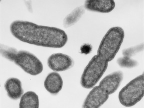 Electron micrograph images of E.coli are shown in a handout photo. MCR-1, a gene that makes bacteria resistant to the killing effects of antibiotics, has been detected in stored samples of E. coli collected in 2010 in Canada. Now scientists are wondering if the superbug gene had made its way into Canada even earlier - and just what that could mean.