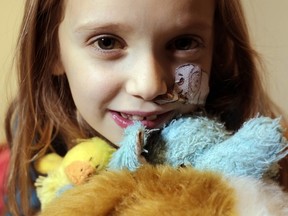 Gianna-Lynn Favilla, 8, who suffers from Crohn's disease and from primary sclerosing cholangitis (PSC), hugs her stuffed elephant, Ellie, in her Russell home Thursday February 04, 2016. Ellie has been with Gianne-Lynn through all her hospital visits. Gianna-Lynn now requires a liver transplant if she is to have a future. (Darren Brown. Assignment 122808