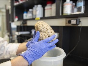 A team of Ottawa researchers have discovered an important piece of the puzzle that could lead to better treatment for the deadliest form of brain cancer, glioblastoma.