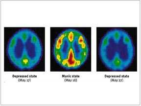 Depressed-Manic-Depressed-FINAL