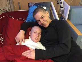 Jonathan Pitre and his mom, Tina Boileau, have shaved their heads after Jonathan's hair began to fall out by the handful following his chemo treatments.
