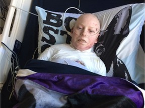 Jonathan Pitre has been discharged from University of Minnesota Masonic Children's Hospital but still must visit every day or two for followup and tests.