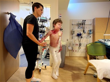 The night before Jonathan Pitre's last round of chemotherapy (Sunday, Sept. 12, 2016) is bath time in his room at the University of Minnesota Masonic Children's Hospital.  It is a four-hour ordeal where his mother, Tina Boileau, carefully removes and replaces the dressings that cover almost his entire body. As his mother punctures the blisters and gently pads them with gauze, the agony becomes unbearable at times - especially in his weakened condition - and he needs another bump of painkillers. The chemo and radiation have removed all of his white blood cells, he's running a fever of 105 degrees on this night and he's exhausted.  This is the critical post-transplant period where his body is reduced to an empty shell in the hopes his mother's transplanted stem cells will take hold inside of him and help reverse the catastrophic symptoms of his Epidermolysis Bullosa (EB.  Julie Oliver/Postmedia