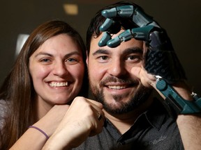 David Chasse, with girlfriend Karine Turpin, had most of his left hand ripped off when a speeding van sideswiped his motorcycle in June 2015. He received the first hand 3D-printed at The Ottawa Hospital's General campus on Thursday Feb. 2, 2017.