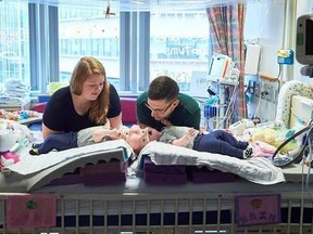 In this April 17, 2017, photo provided by the Children&#039;s Hospital of Philadelphia shows Heather Delaney, left rear, and Riley Delaney care for their conjoined twin daughters Abby, left, and Erin, who had been preparing for separation surgery by undergoing treatment to expand skin on their scalps using implanted balloons, at the Children&#039;s Hospital of Philadelphia in Philadelphia. Hospital officials say surgeons successfully separated the 10-month-old twins June 6 during an 11-hour surgery.