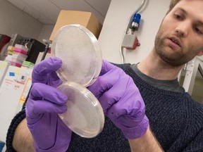 In this Tuesday, April 25, 2017 photo, assistant research technician Henri Berger, talks about live yeast cultures at a New York University lab in the Alexandria Center for Life Sciences in New York, where researchers are attempting to create completely man-made, custom-built DNA. The yeast genome is like a chain with 12 million chemical links, known by the letters, A, C, T and G. That‚Äôs less than one-hundredth the size of the human genome, which has 3.2 billion links. (AP Photo/Mary Altaffer)