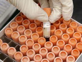 A researcher pulls a frozen vial of human embryonic stem cells at the University of Michigan Center for Human Embryonic Stem Cell Research Laboratory in Ann Arbor, Mich., in this Oct. 22, 2008 file photo. The face of science, writes Kristin Baetz, should be changing, and here's how to do it. Paul Sancya, THE ASSOCIATED PRESS