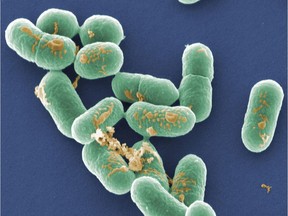 Listeria monocytogenes, magnified 20,000x.