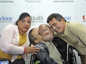 Emanuel Zayas, 14, will have surgery at Holtz Children's Hospital at Jackson Memorial in Miami, this holiday season to remove a 10-pound tumor that covers his face from a disorder called polyostotic fibrous dysplasia /